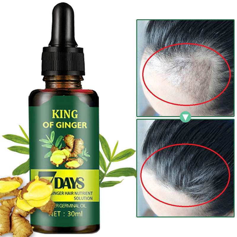 Ginger Hair Nutrient Solution — 30ml