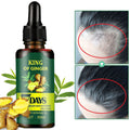 Ginger Hair Nutrient Solution — 30ml